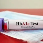 HbA1c Test