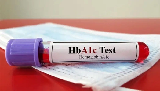 HbA1c Test