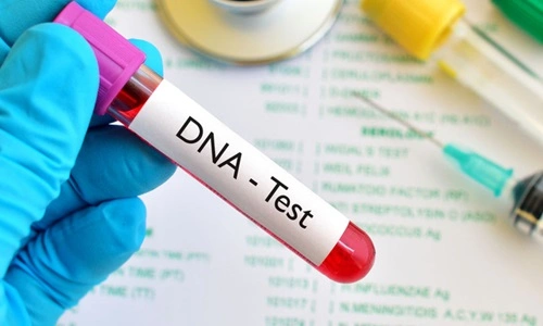 DNA Testing