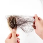 Hair Fall During Monsoon
