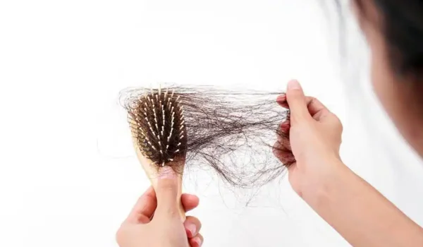 Hair Fall During Monsoon