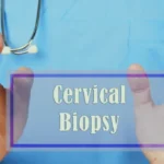 Cervical Biopsy